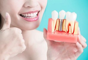 Преимущества восстановления зубов