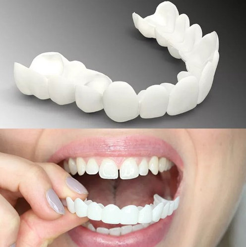 Какие виниры для зубов лучше?
