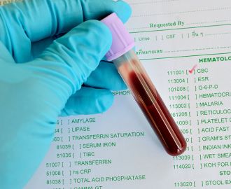 Когда нужно сдавать клинический анализ крови?