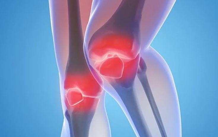 Лечение артроза коленного сустава: лучшие методы