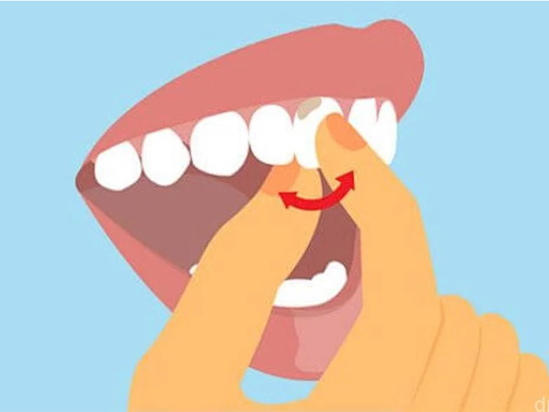 Шатаются зубы у взрослого: что делать?