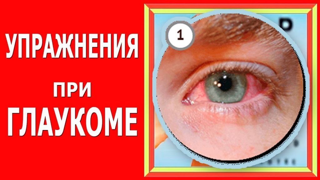 Гимнастика и упражнения для глаз при глаукоме