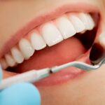 Советы стоматолога по уходу за зубами