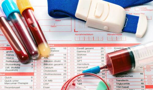 Как подготовиться к сдаче анализов крови?