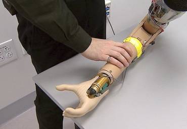 Как устроены бионические протезы ?