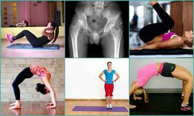 Какие упражнения показаны при таком заболевании, как коксартроз тазобедренного сустава