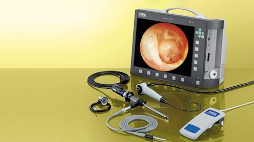 Эндоскопическая камера: медицинский прибор для эндоскопической хирургии