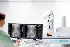 Особенности выбора рентгеновского аппарата