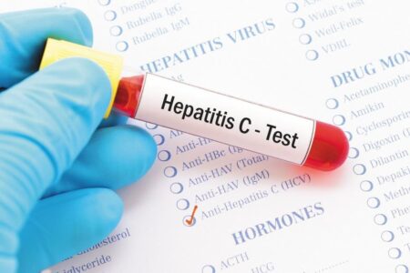 Какие анализы показывают гепатит С?