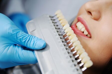 Какие существуют виды отбеливания зубов?