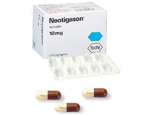 Применение препарата Неотигазон