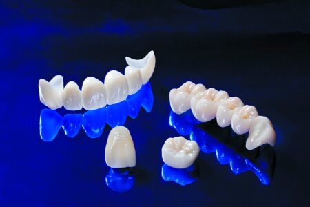 Коронки из диоксида циркония: Совершенство в стоматологии