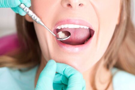 Показания к установке пломбы на зуб