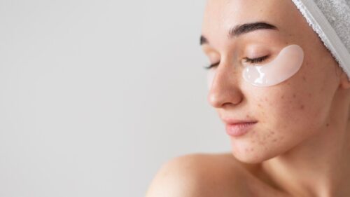 Убрать постакне пилингом: как вернуть коже чистоту и гладкость