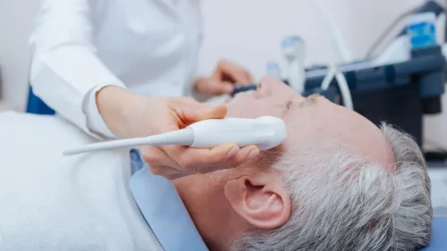 УЗИ сосудов головного мозга: все, что нужно знать о диагностике