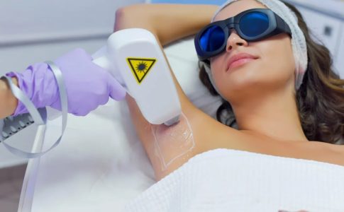 Без боли и раздражения: современная лазерная эпиляция