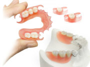 Съемные зубные протезы: виды