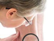 Какими заболеваниями занимается дерматовенеролог?