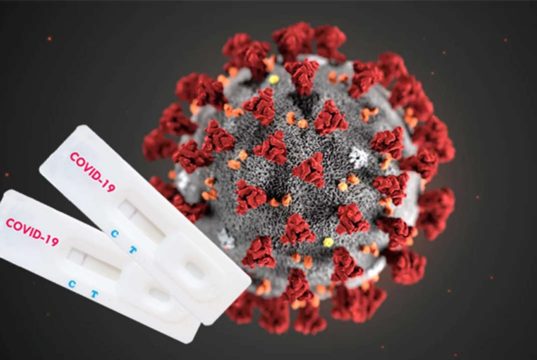 Как проходит процедура экспресс-теста на COVID-19?