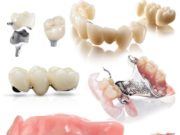 Съемное зубное протезирование: активно используется в современной ортопедической стоматологи