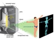 Принцип работы цифрового рентгеновского аппарат