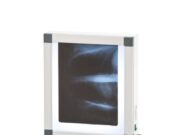 Для чего нужен негатоскоп?