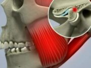 ВНЧС методики лечения
