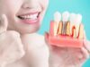 Преимущества восстановления зубов