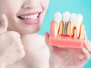 Преимущества восстановления зубов