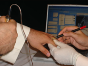 Метод Фолля: принцип работы