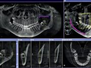 Компьютерная томография челюсти: современный метод неинвазивной диагностики