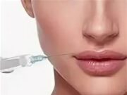 Разновидности филлеров в контурной пластике