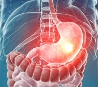 Язва желудка: одно из самых распространенных заболеваний желудочно-кишечного тракта