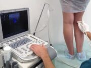 Когда нужно проводить УЗДГ вен нижних конечностей?