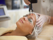 Особенности лазерного пилинга