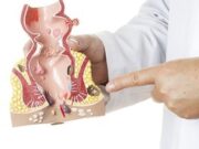 Проктологические заболевания