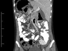 Как проходит КТ органов брюшной полости?