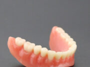 Виды зубных протезов: какие самые лучшие?