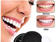 Какое отбеливание зубов самое безопасное и эффективное?