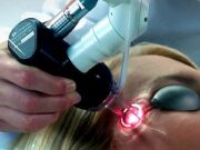 Лазерная косметология : новое слово в безоперационном омоложении