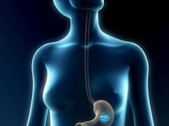 Особенности установки внутрижелудочного баллона