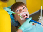 Рекомендации после профессиональной чистки зубов