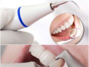 Виды профессиональной чистки зубов