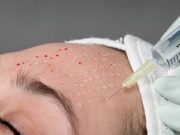 Биоревитализация лица: особенности процедуры