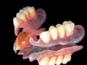 Что представляет собой нейлоновый зубной протез?