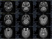 Расшифровка снимков и результатов МРТ онлайн