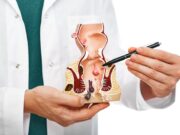 Какие заболевания может выявить врач-проктолог?