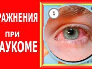 Гимнастика и упражнения для глаз при глаукоме