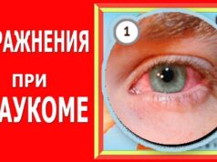 Гимнастика и упражнения для глаз при глаукоме
