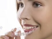 Элайнеры Star Smile: какие проблемы с прикусом решает?